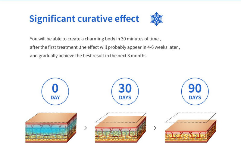 Shape Tactics - Máquina de adelgazamiento con criolipólisis y congelación de grasa al vacío para eliminar la celulitis y moldear el cuerpo