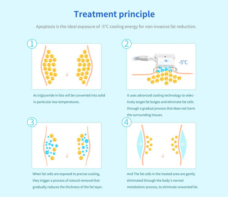 Shape Tactics - Máquina de adelgazamiento con criolipólisis y congelación de grasa al vacío para eliminar la celulitis y moldear el cuerpo