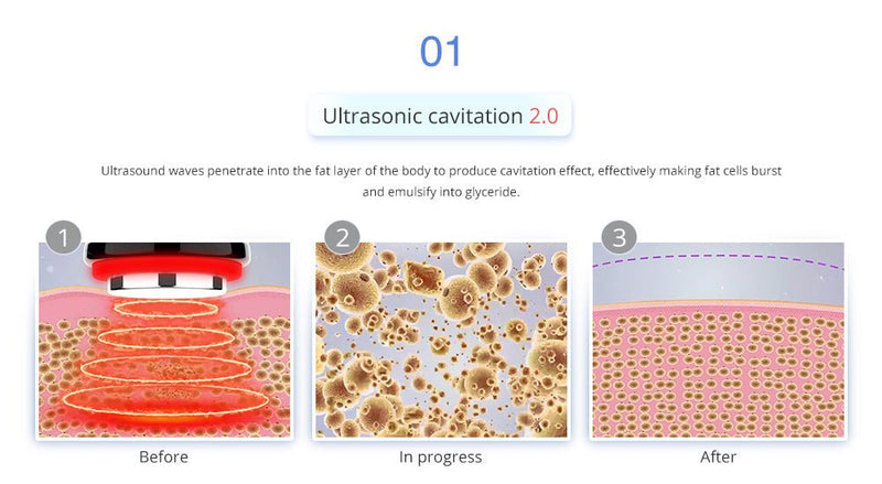 Máquina de cavitación por vacío en frío y criolipólisis 4 en 1 Shape Tactics