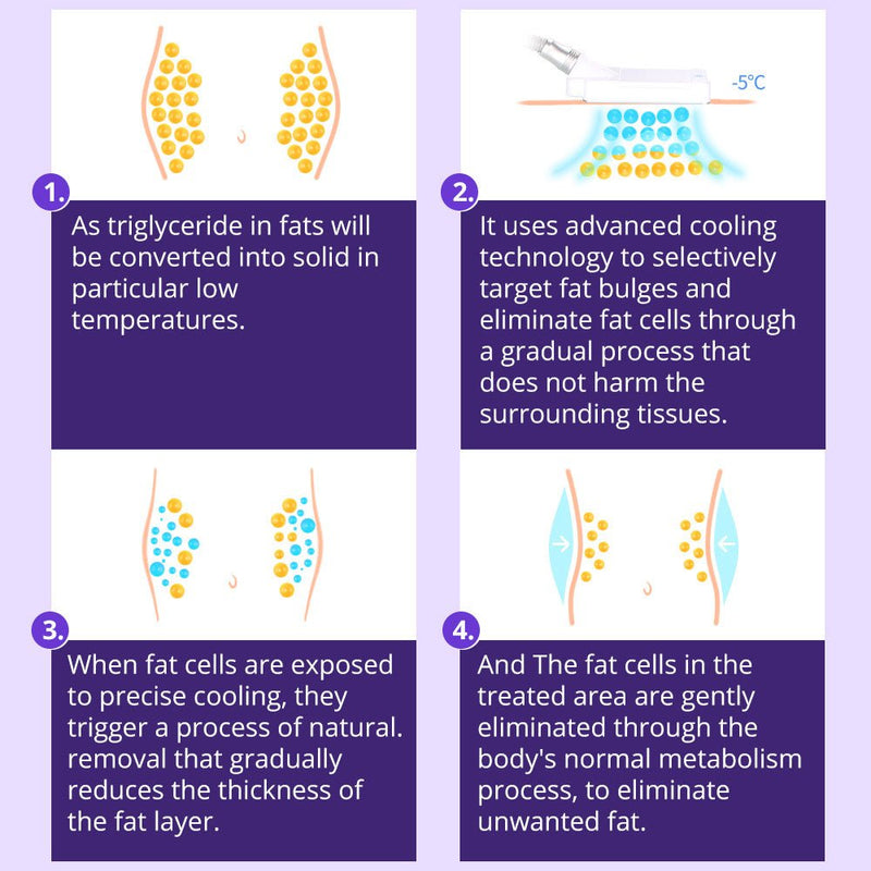 Máquina de belleza de congelación de grasa por criolipólisis de 4 almohadillas Shape Tactics