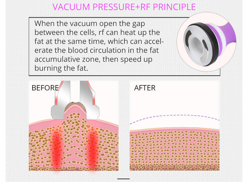 Máquina de cavitación RF para adelgazar el cuerpo 5 en 1 Shape Tactics