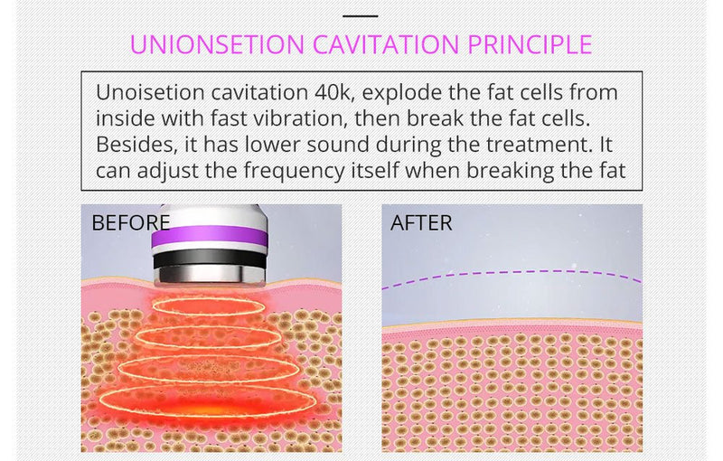 Máquina de cavitación RF para adelgazar el cuerpo 5 en 1 Shape Tactics