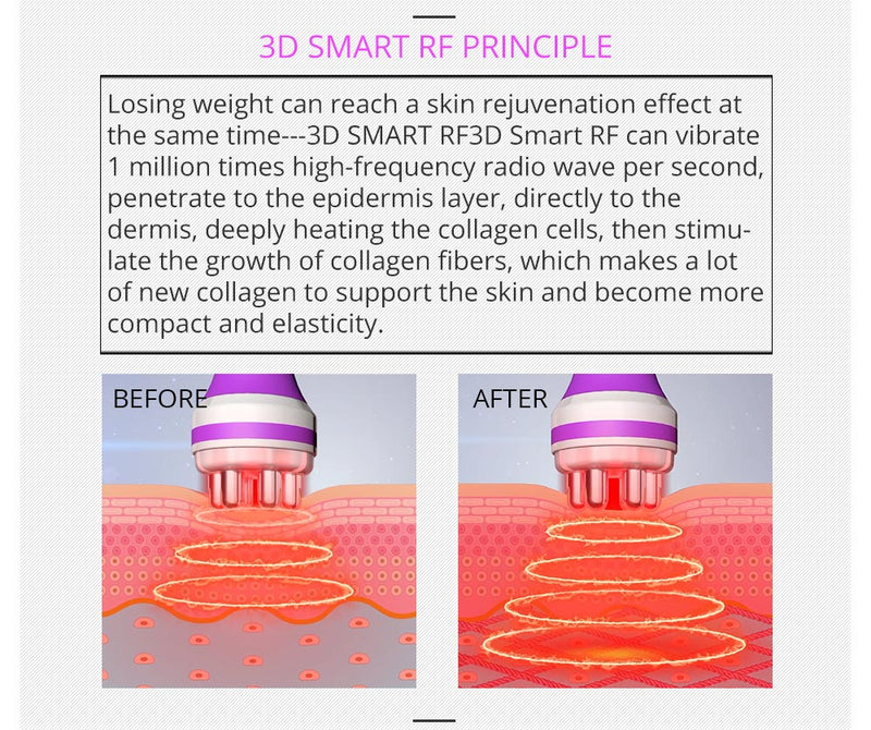 Máquina de cavitación RF para adelgazar el cuerpo 5 en 1 Shape Tactics