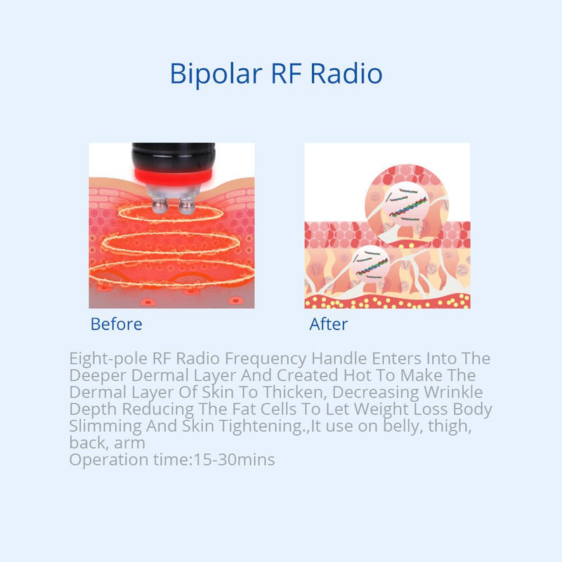 Sistema de enfriamiento por criolipólisis con doble mango y cavitación RF 5 en 1 de Shape Tactics