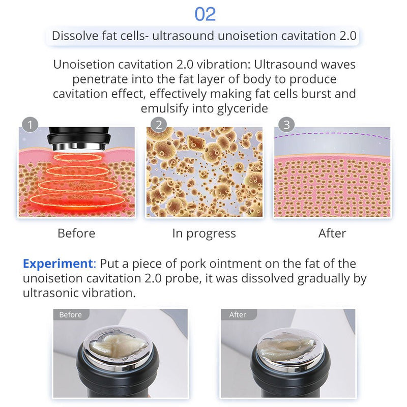 Máquina de cavitación ultrasónica RF para adelgazar Shape Tactics 5 en 1 Unoisetion 