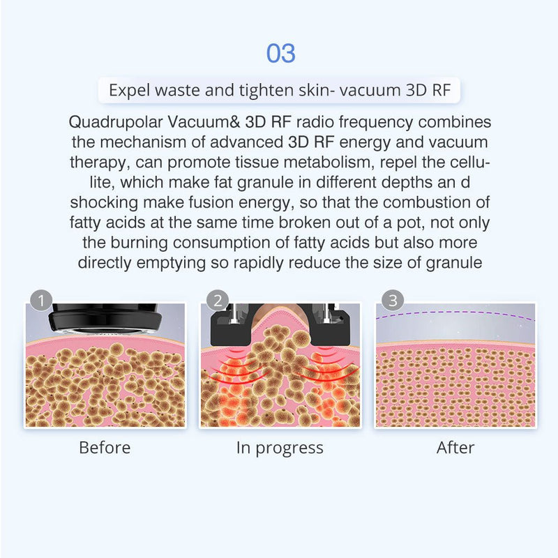 Máquina de cavitación ultrasónica RF para adelgazar Shape Tactics 5 en 1 Unoisetion 