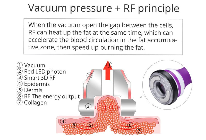 Máquina de terapia de cavitación RF 40K 5 en 1 de Shape Tactics