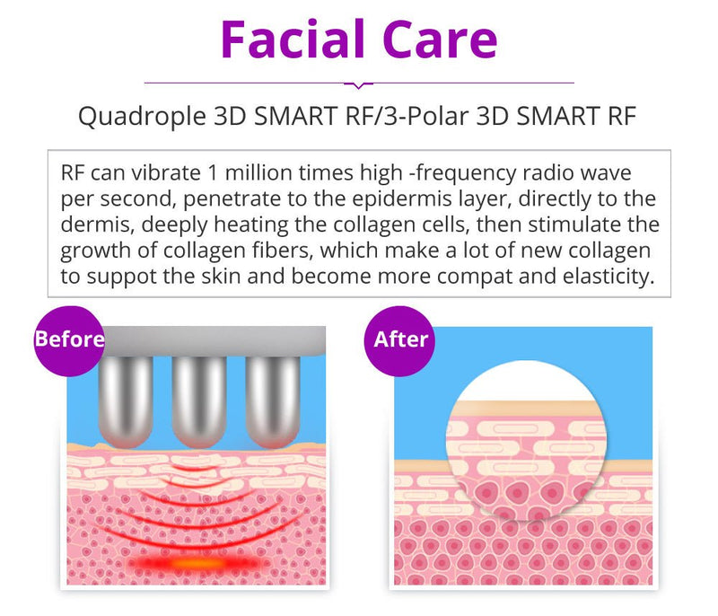 Máquina de terapia de cavitación RF 40K 5 en 1 de Shape Tactics