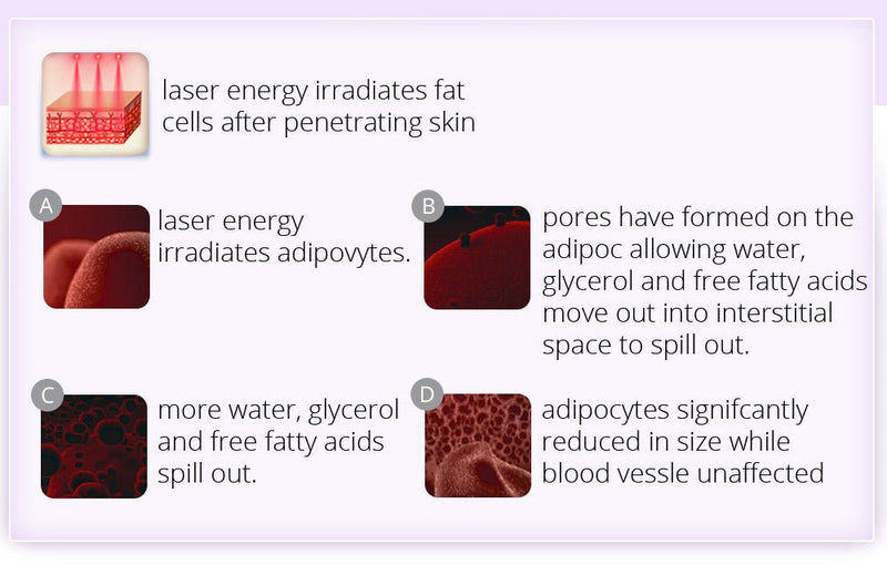 Dispositivo de adelgazamiento corporal RF con cavitación ultrasónica de liposucción de 2,5 pulgadas 6 en 1 de Shape Tactics