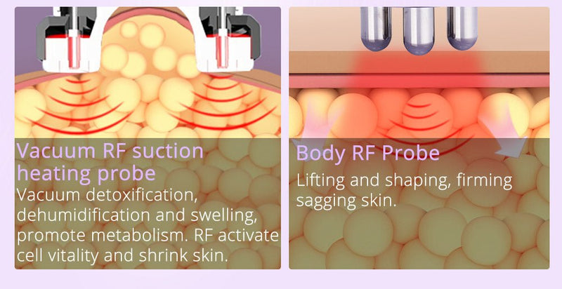 Dispositivo de adelgazamiento corporal RF con cavitación ultrasónica de liposucción de 2,5 pulgadas 6 en 1 de Shape Tactics