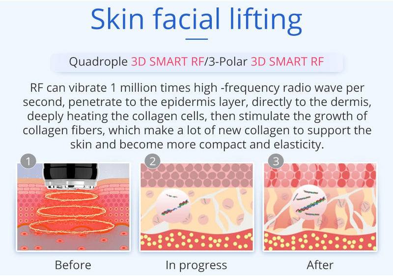 Shape Tactics 6 en 1 Cavitación avanzada de unificación 2.0 para modelado corporal por radiofrecuencia al vacío