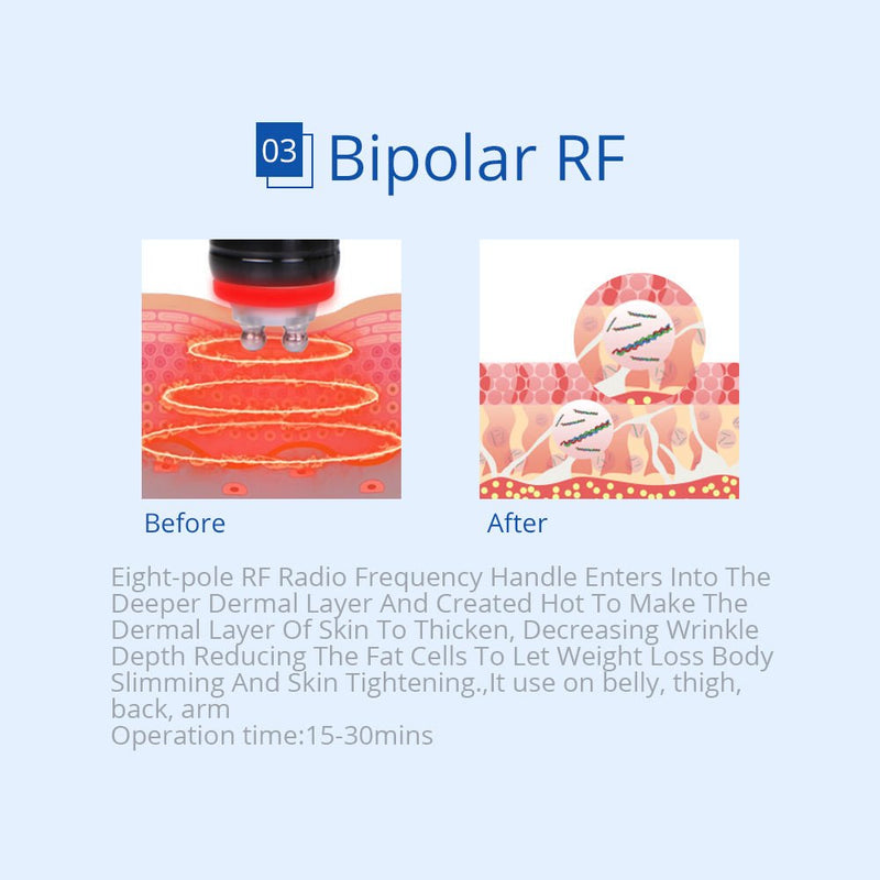 Máquina de criolipólisis por radiofrecuencia con láser liposucción y cavitación 6 en 1 de Shape Tactics