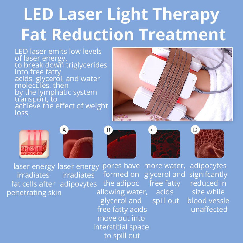 Máquina de criolipólisis por radiofrecuencia con láser liposucción y cavitación 6 en 1 de Shape Tactics