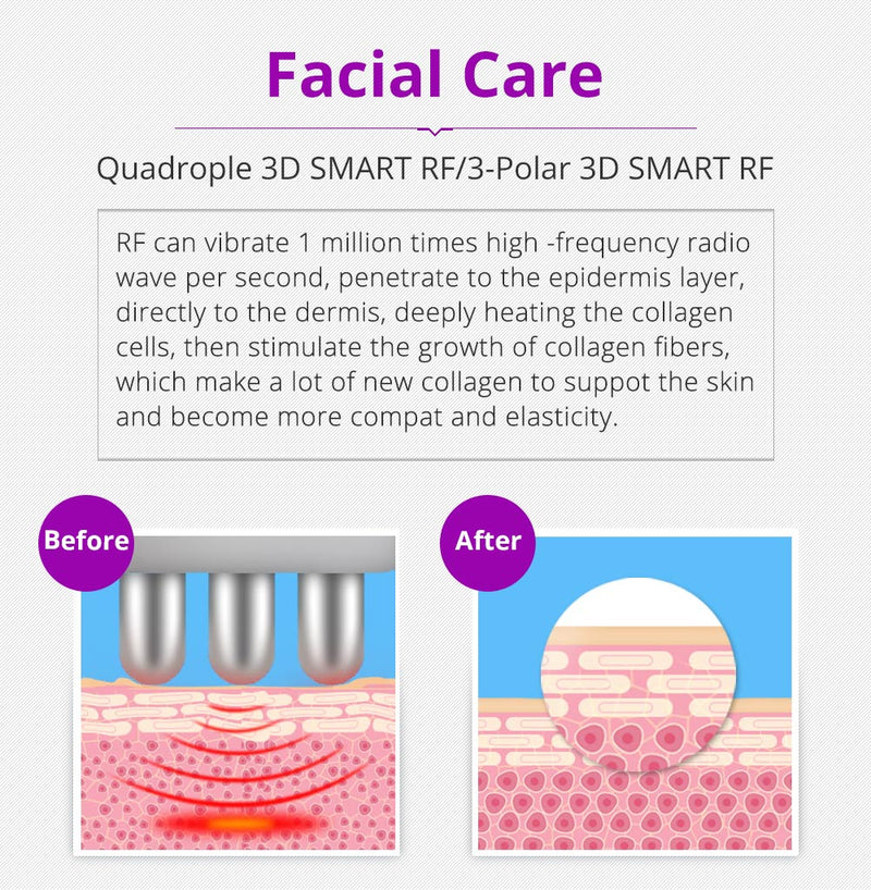 Sistema de modelado corporal 6 en 1 con cavitación, láser, liposucción y radiofrecuencia de Shape Tactics