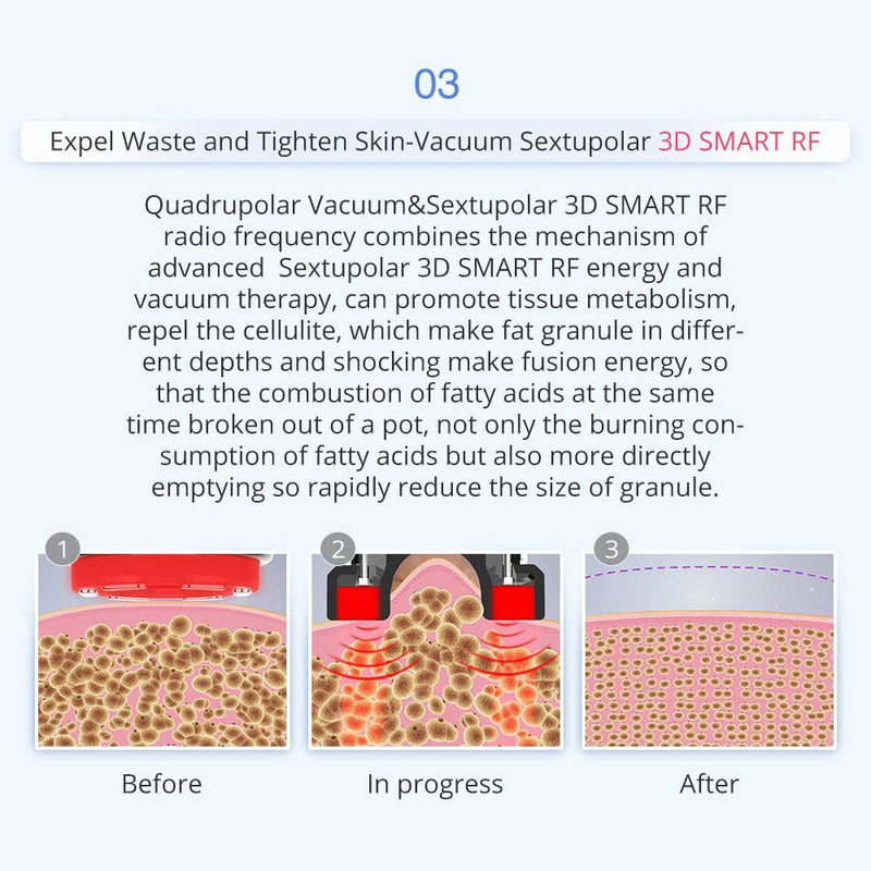 Shape Tactics - Máquina de cavitación láser de radiofrecuencia con microcorriente 8 en 1