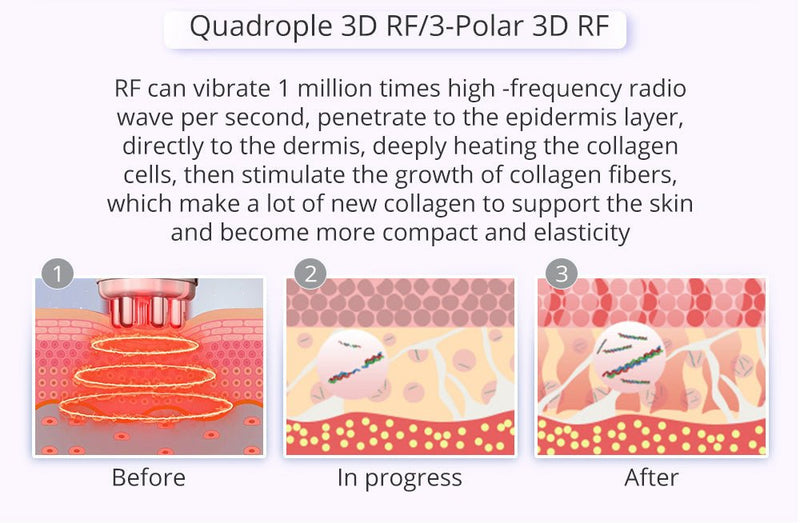 Shape Tactics - Cavitación ultrasónica con fotones y microcorriente Lipo 9 en 1