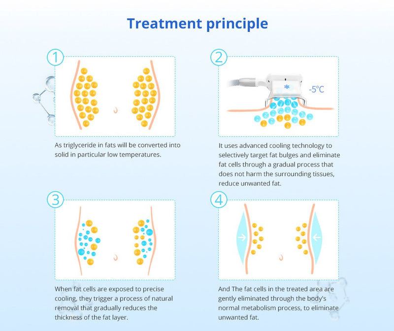 Shape Tactics - Máquina de adelgazamiento avanzada con congelación de grasa que se coloca de pie 