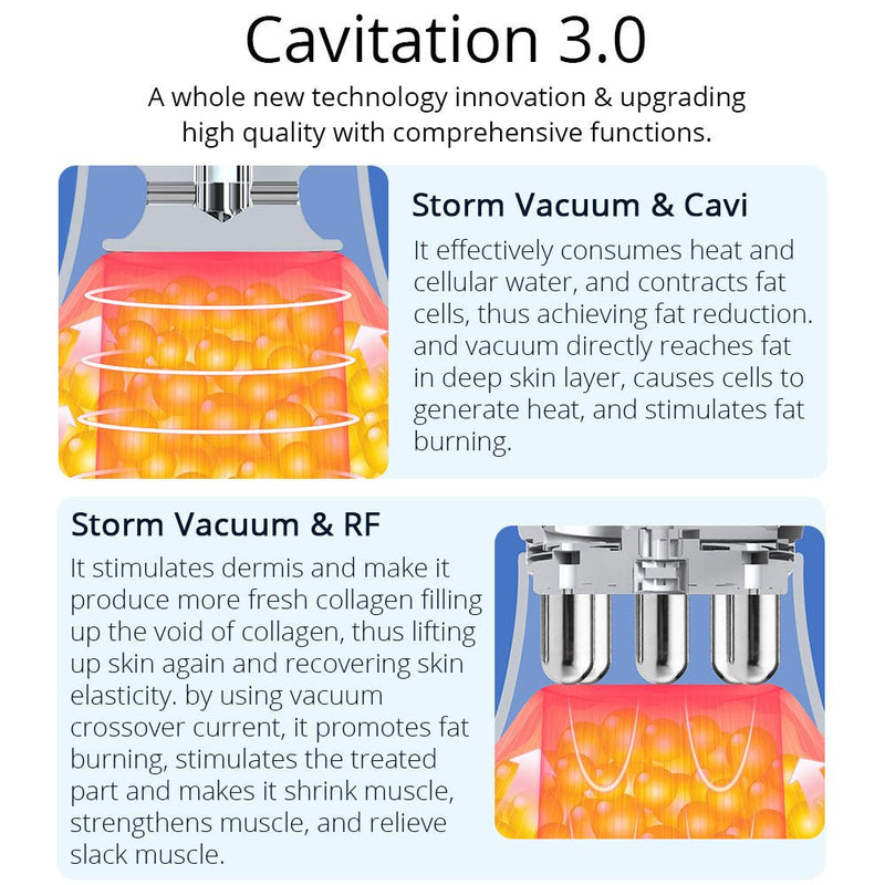 Máquina de cavitación Shape Tactics CaVstorm 40K 3.0 con funcionalidad 4 en 1