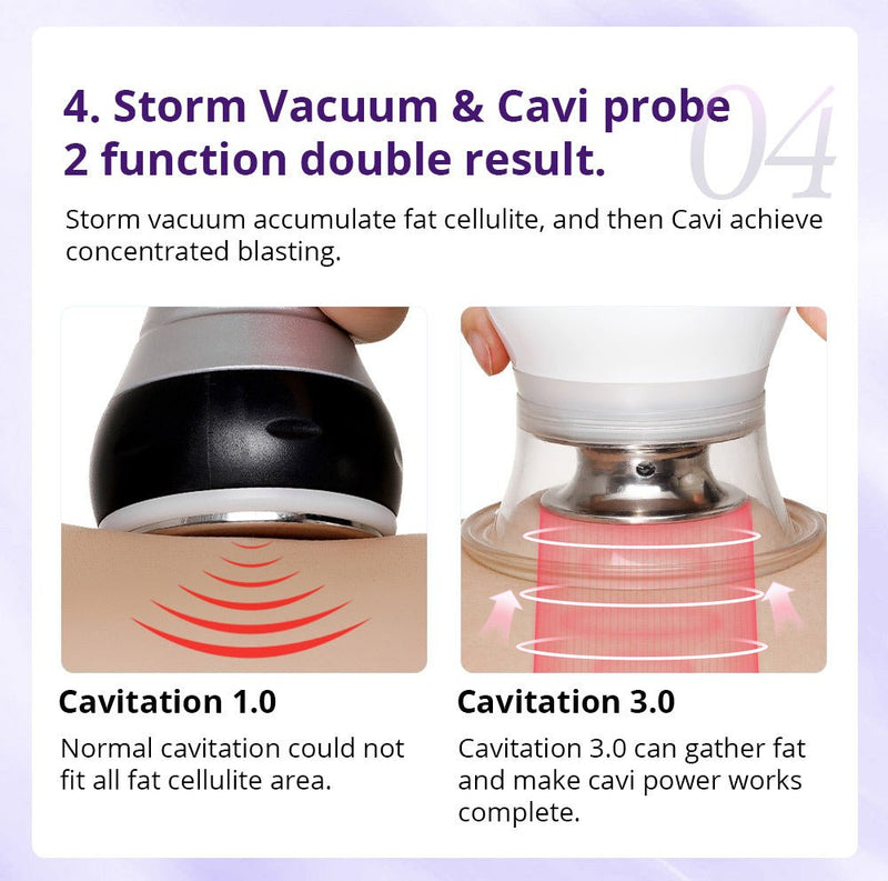 Cavitación Shape Tactics Cavstorm 40K 3.0 con tecnología de microcorriente