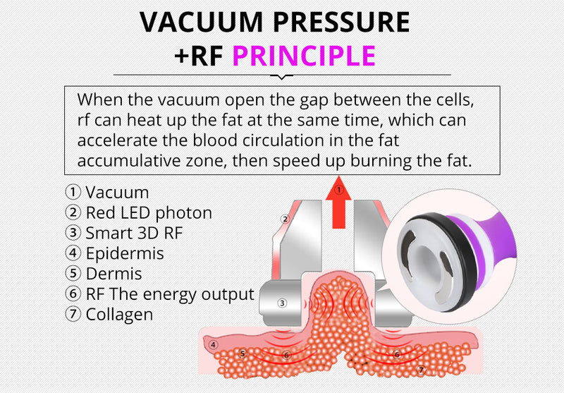 Dispositivo de belleza RF por vacío y cavitación ultrasónica multifuncional 5 en 1 de Shape Tactics