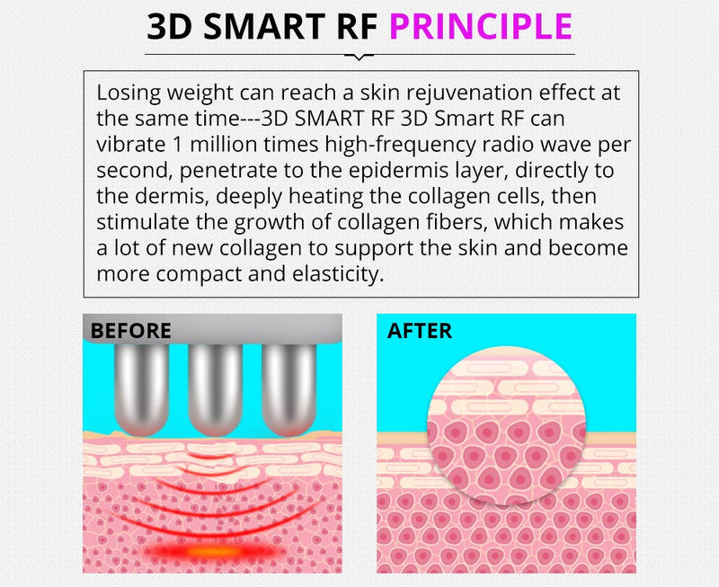 Dispositivo de belleza RF por vacío y cavitación ultrasónica multifuncional 5 en 1 de Shape Tactics