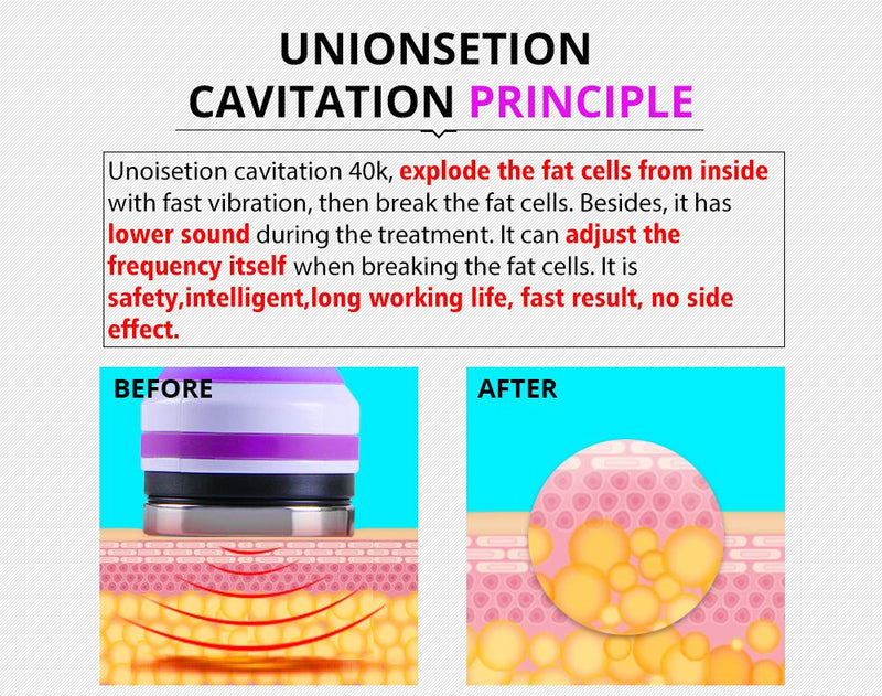 Dispositivo de belleza RF por vacío y cavitación ultrasónica multifuncional 5 en 1 de Shape Tactics