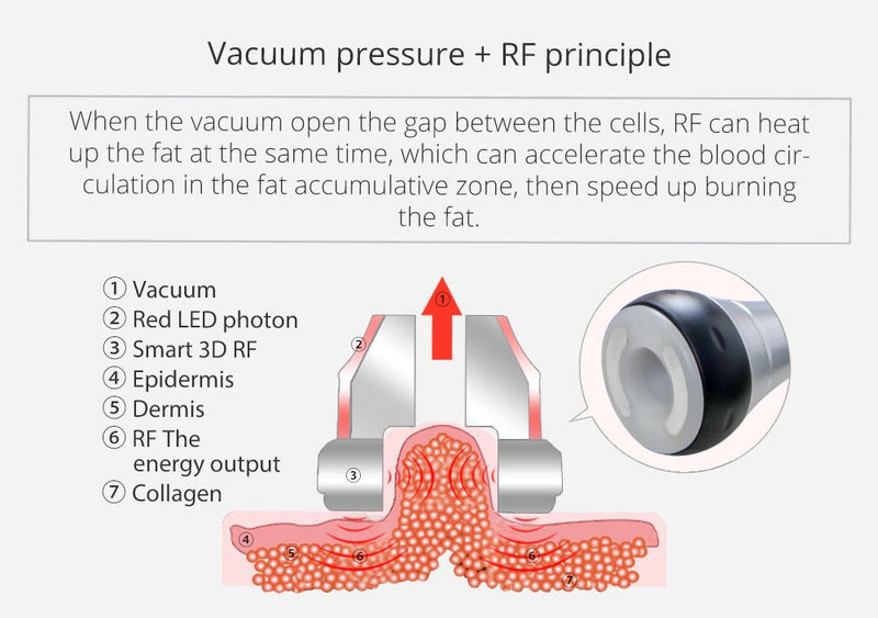 Shape Tactics Portable 6-in-1 40K Lipo Cavitation Vacuum RF Slimming Machine