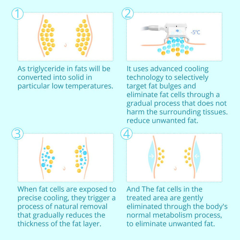 Shape Tactics - Dispositivo portátil de doble manija para modelar el cuerpo mediante congelación de grasa por criolipólisis