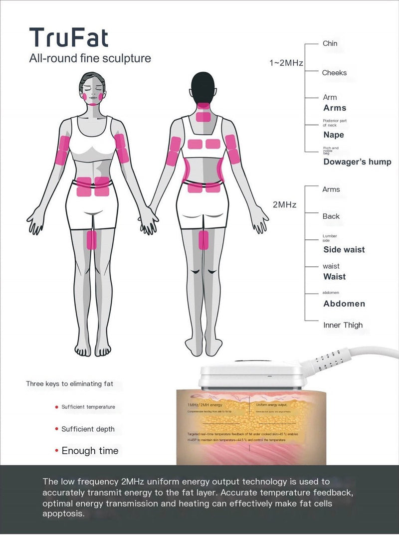 Shape Tactics - Smart RF Body Sculpting Device