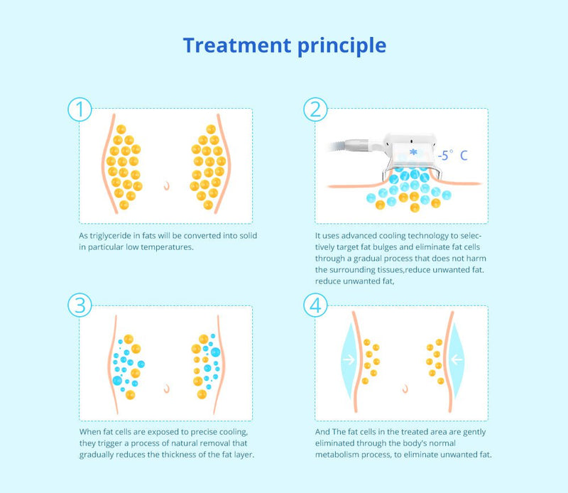 Shape Tactics - Máquina de vacío para celulitis con triple mango y congelación de grasa