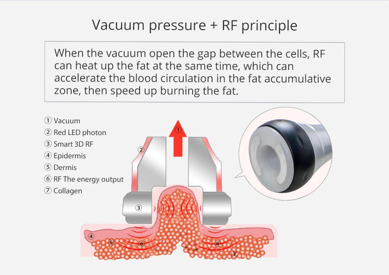 Shape Tactics - Unoisetion 40k Cavitación Ultrasonido RF Multipolar Vacío Fotón