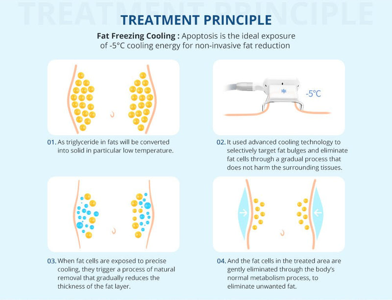 Máquina de adelgazamiento por vacío con criolipólisis y eliminación de papada Shape Tactics